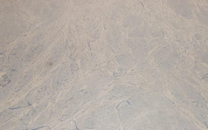 Normal tendon tissue at 10x staining with S-100 immunohistochemical staining (no positive staining observed)
